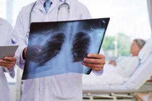 Understanding Chest Injuries